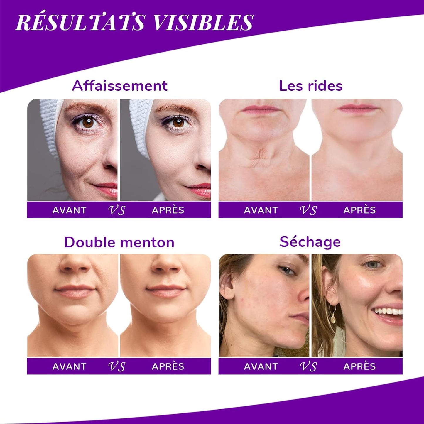 Anairui Crème Raffermissante Pour Le Cou, Hydratante Anti-Âge Pour Le Cou Et Le Décolleté Avec Bakuchiol, Collagène Et Céramides, Crème Anti-Rides Pour Femmes Et Hommes, 50 Ml